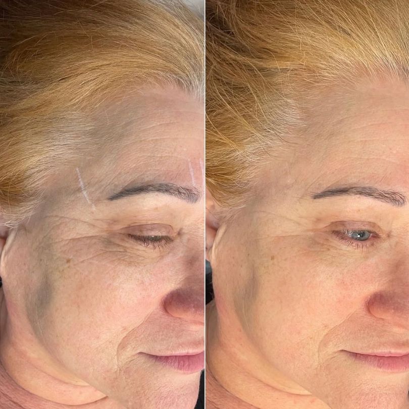 Before After New 1