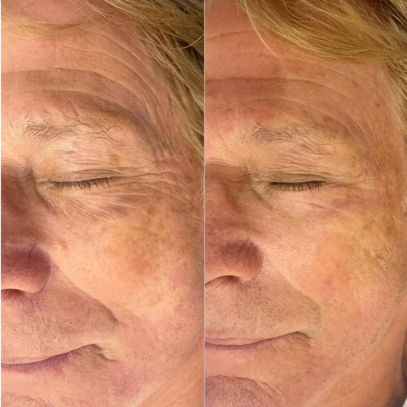 Before After New 2