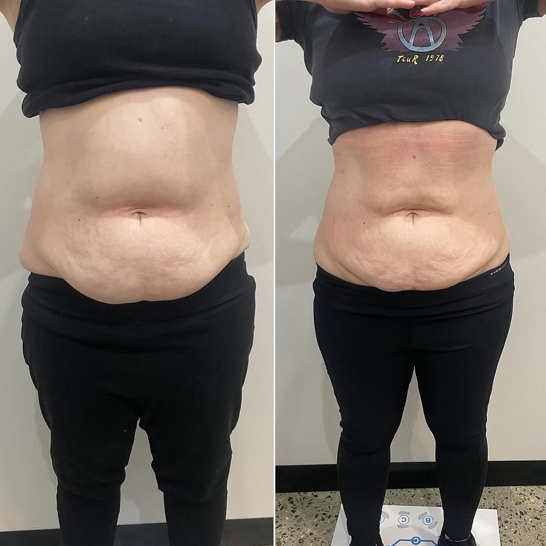 Before and After 2