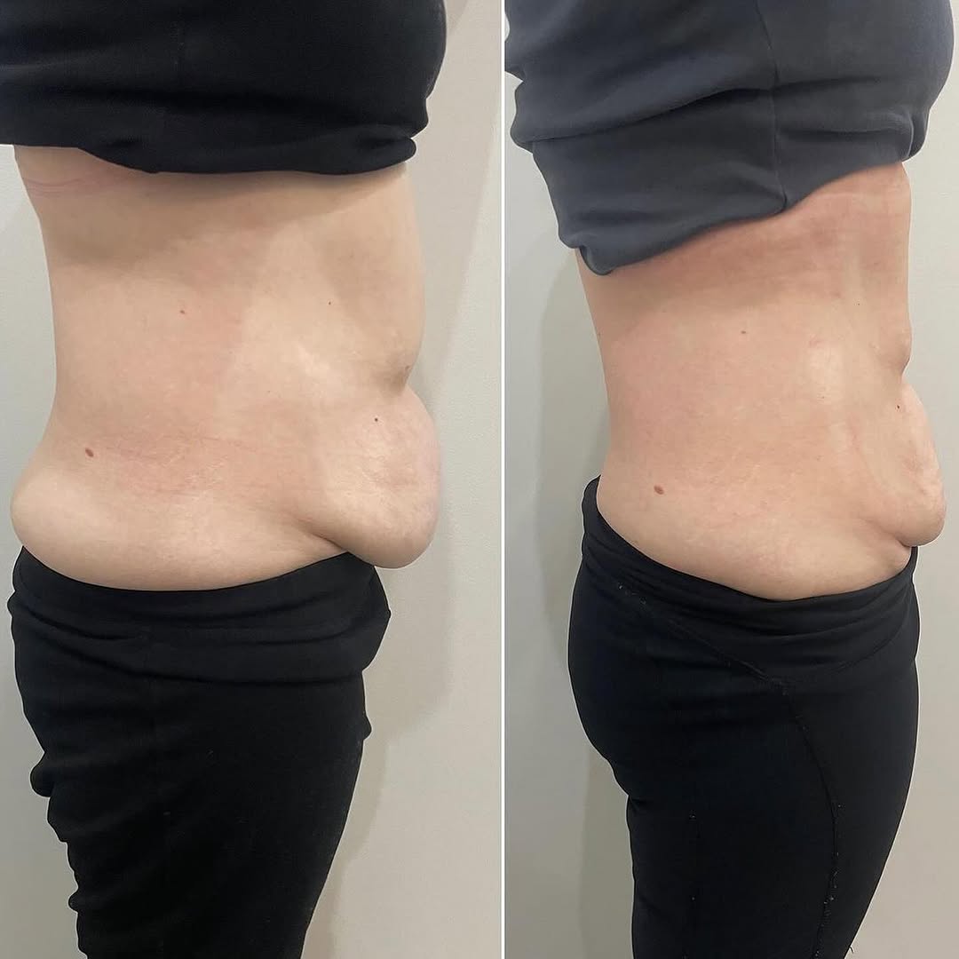 Before and After 3