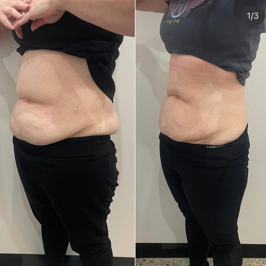 Before and After 4