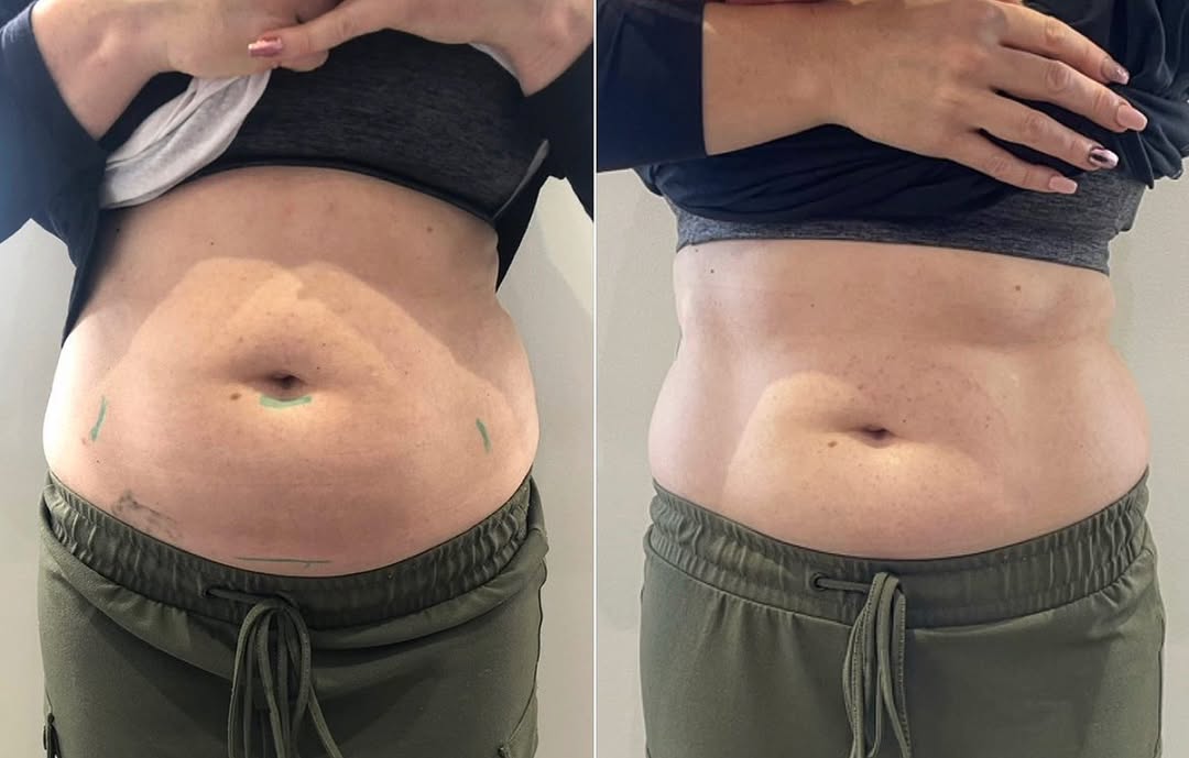 Before and After 10