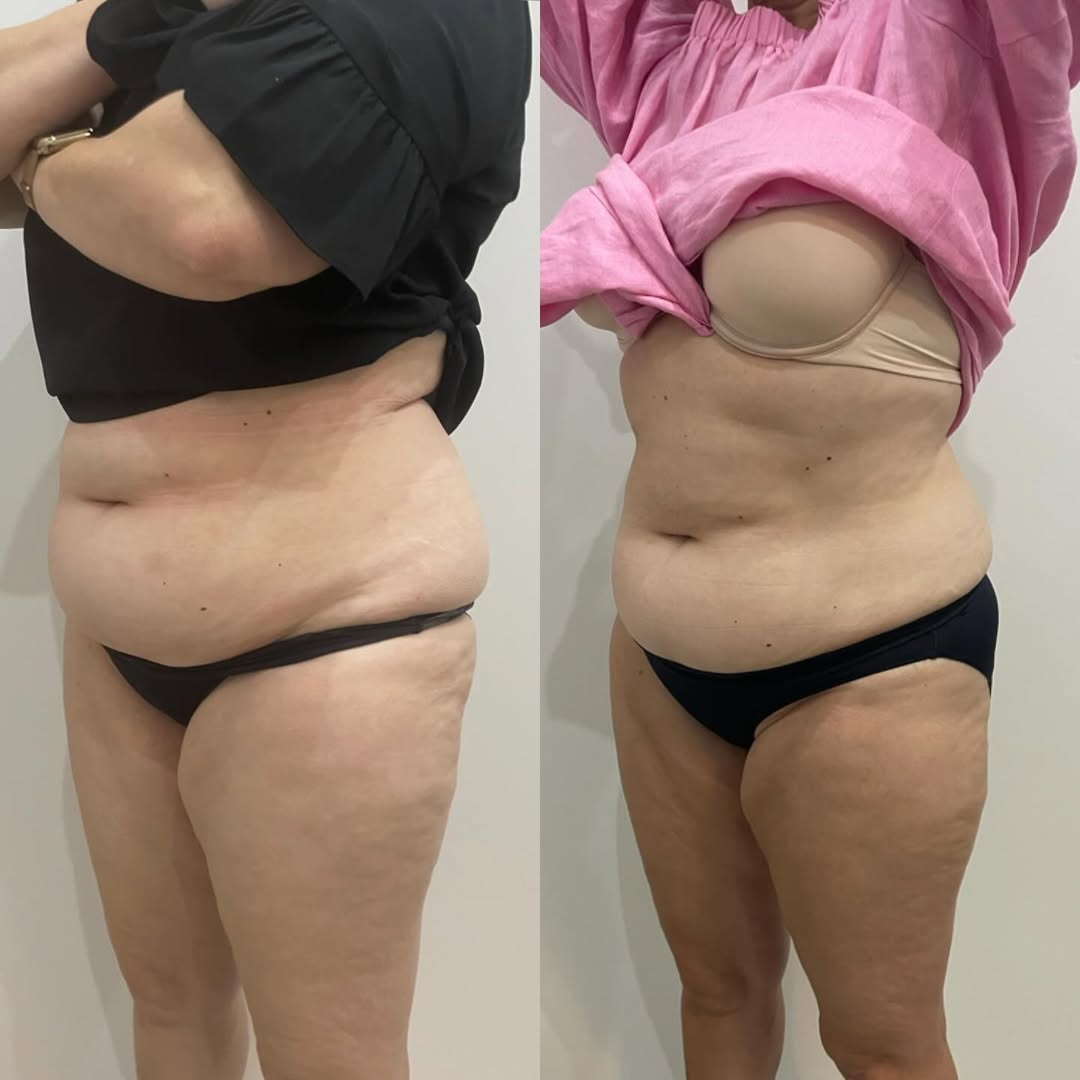 Before and After 6