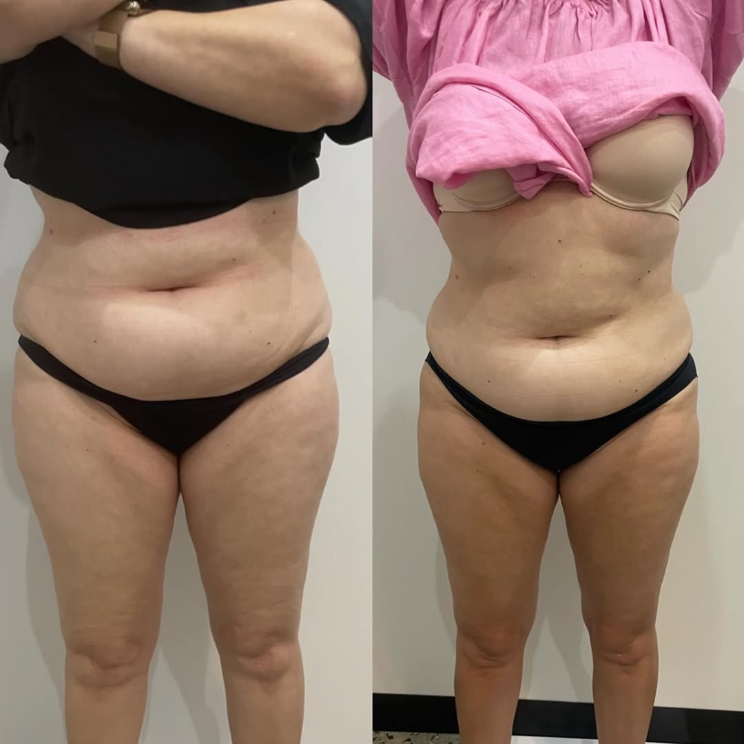 Before and After 8