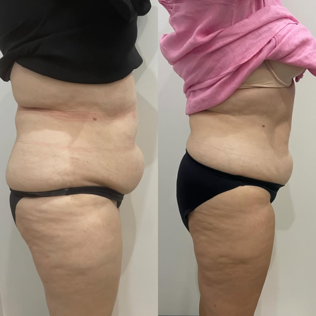 Before and After 5