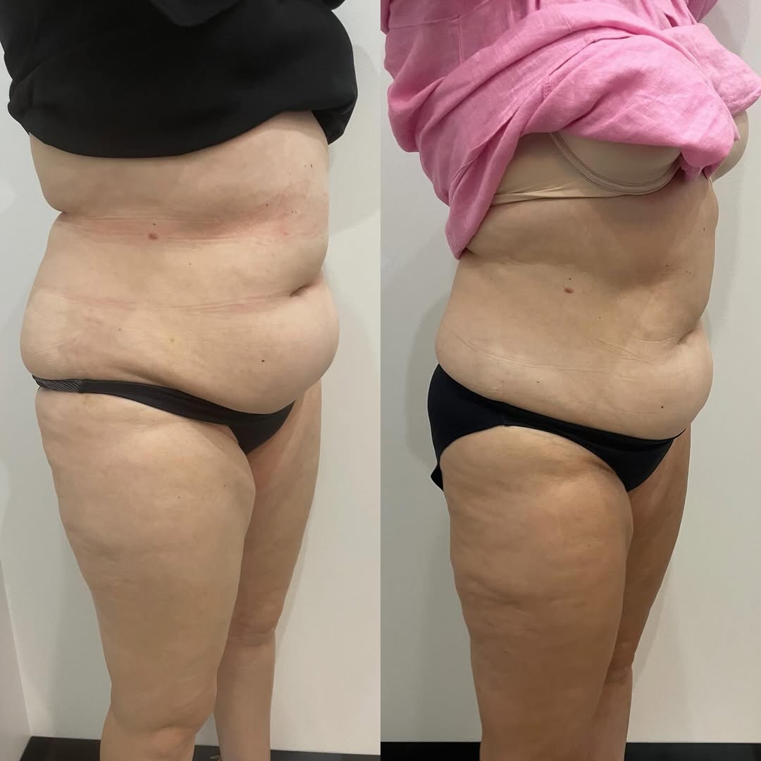 Before and After 7