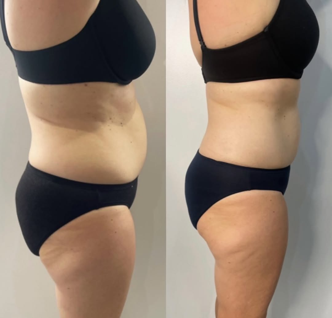 Before and After 9