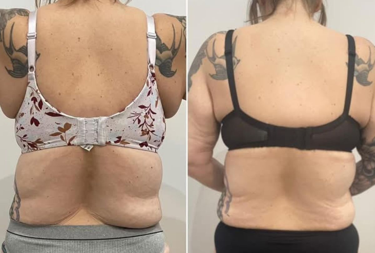 Before After 3